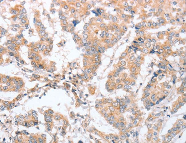 PARD6A / PAR6 Antibody