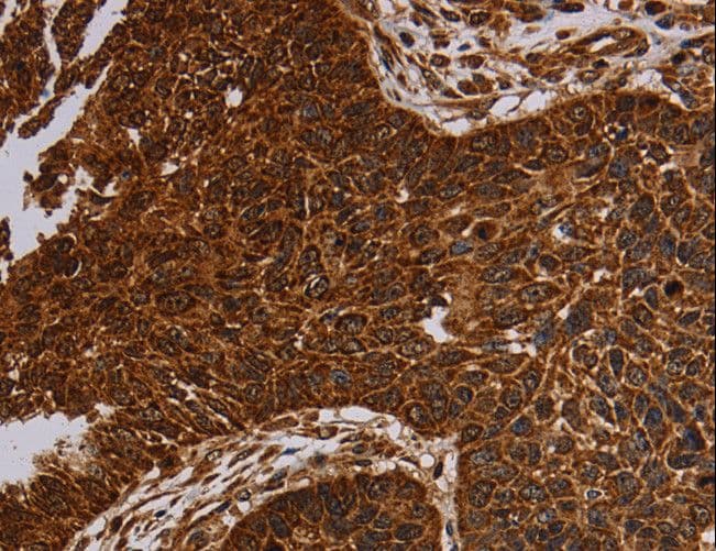 Polyclonal Rabbit anti-Human NDUFAB1 / ACP Antibody (IHC)
