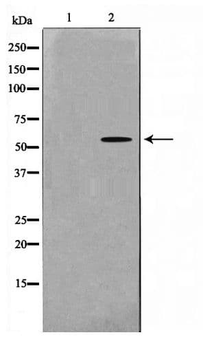 Polyclonal Rabbit anti-Human DOK7 Antibody (IHC, IF, WB)