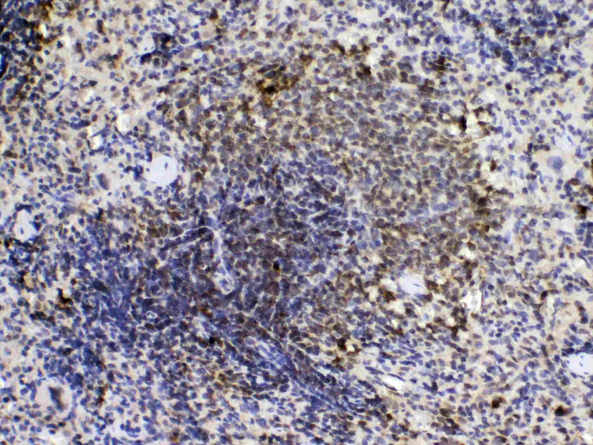 PPIA / Cyclophilin A Antibody