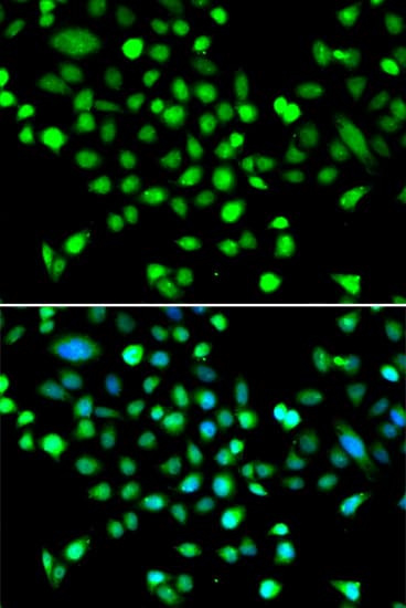 PRKAG1 / AMPK Gamma 1 Antibody
