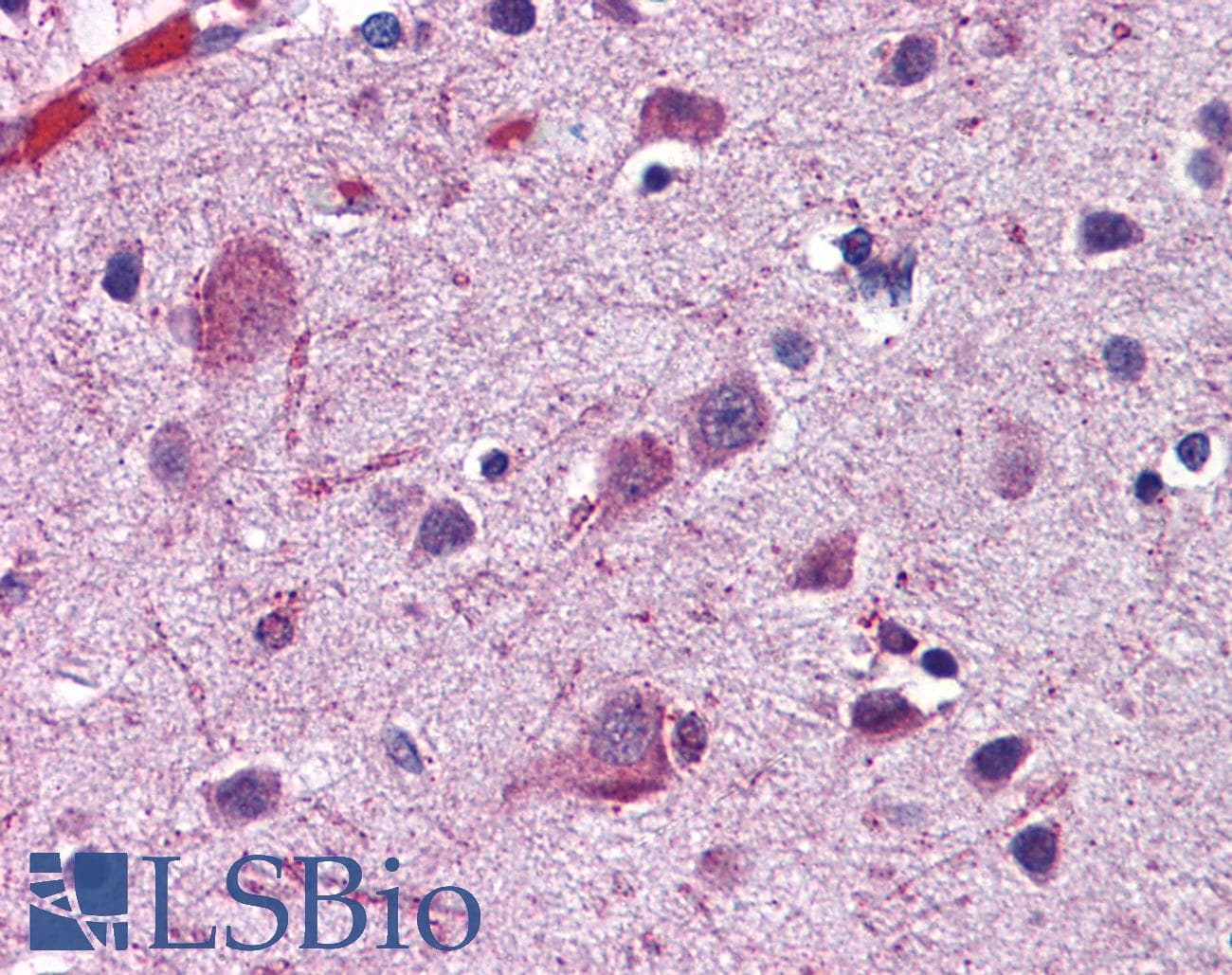 Polyclonal Rabbit anti-Human ACSL4 / FACL4 Antibody (N-Terminus, IHC, WB)