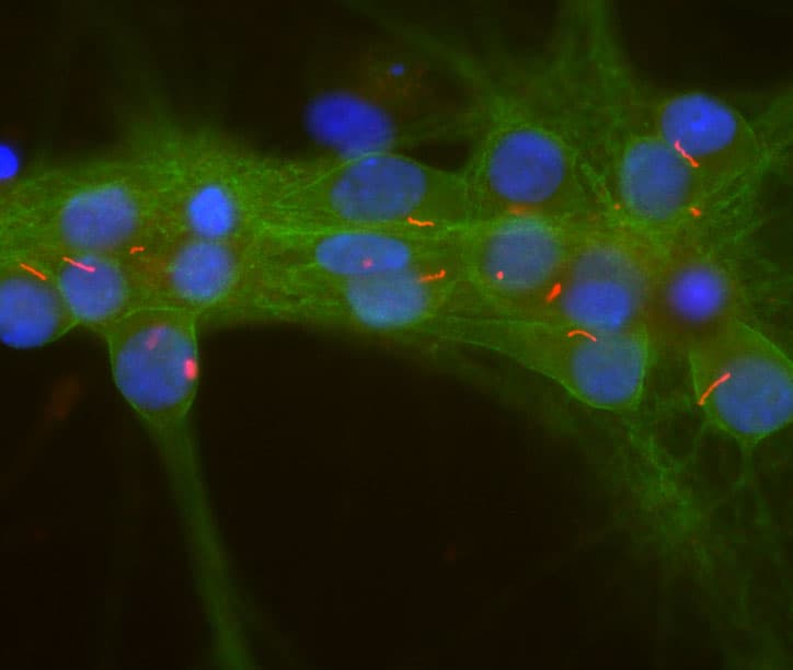ADCY3 / Adenylate Cyclase 3 Antibody (aa1125-1144)