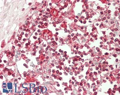 IHC-plus™ Polyclonal Rabbit anti-Human CD3E Antibody (aa 23-207, IHC, WB)