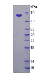 Rat Endonuclease G / ENDOG Protein (Native His-GST, N-terminus)