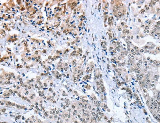 ELAVL1 / HUR Antibody