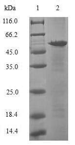 Human ASF1A Protein (Recombinant GST, N-terminus)