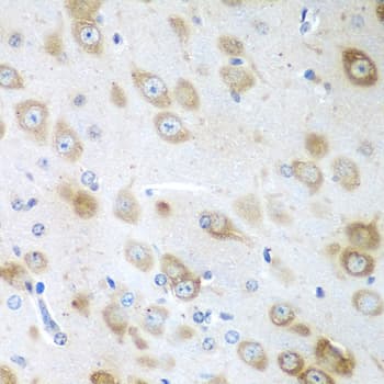 Polyclonal Rabbit anti-Human GFM1 Antibody (IHC, WB)