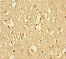 RTN4RL1 / NGRH2 Antibody