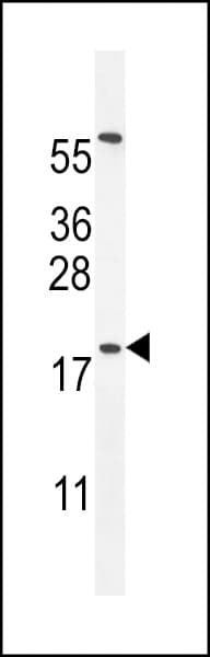 Polyclonal Rabbit anti-Human DPPA5 Antibody (aa2-31, WB)