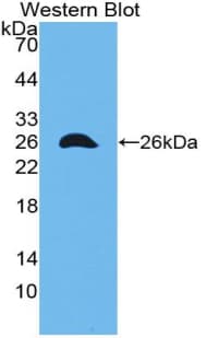 GJA1 / CX43 / Connexin 43 Antibody (aa180-382)
