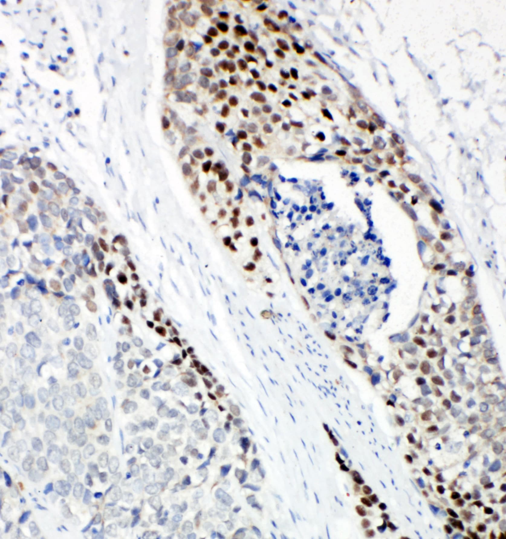 TP63 / p63 Antibody (aa664-680)