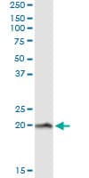 NPC2 Antibody (clone 1F4)