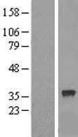 RFC2 / RFC40 Protein (Over-Expression Lysate Myc-DDK (Flag))