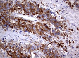 PIK3C2A Antibody (aa230-560, clone OTI3F8)