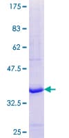 Human LRAT Protein (Recombinant GST, N-terminus)