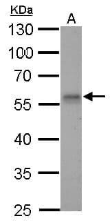 Polyclonal Rabbit anti-Human RAD9A / RAD9 Antibody (aa197-421, IHC, WB)