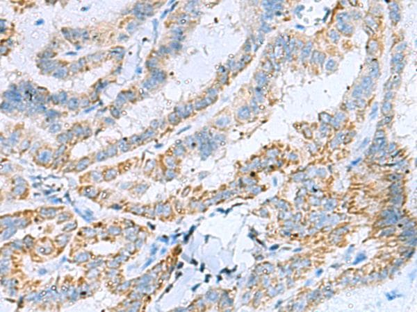 Polyclonal Rabbit anti-Human Kinesin 5A / KIF5A Antibody (IHC)