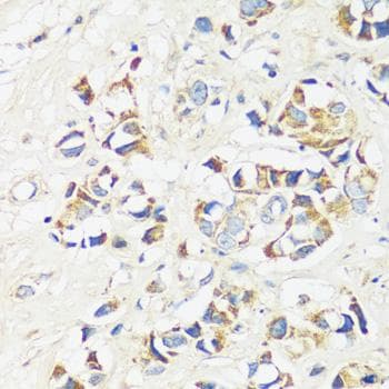 CADPS Antibody
