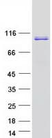 Human UHRF1 Protein (Recombinant Myc-DDK (Flag))