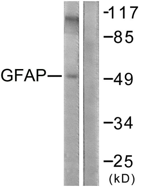 GFAP Antibody (aa11-60)