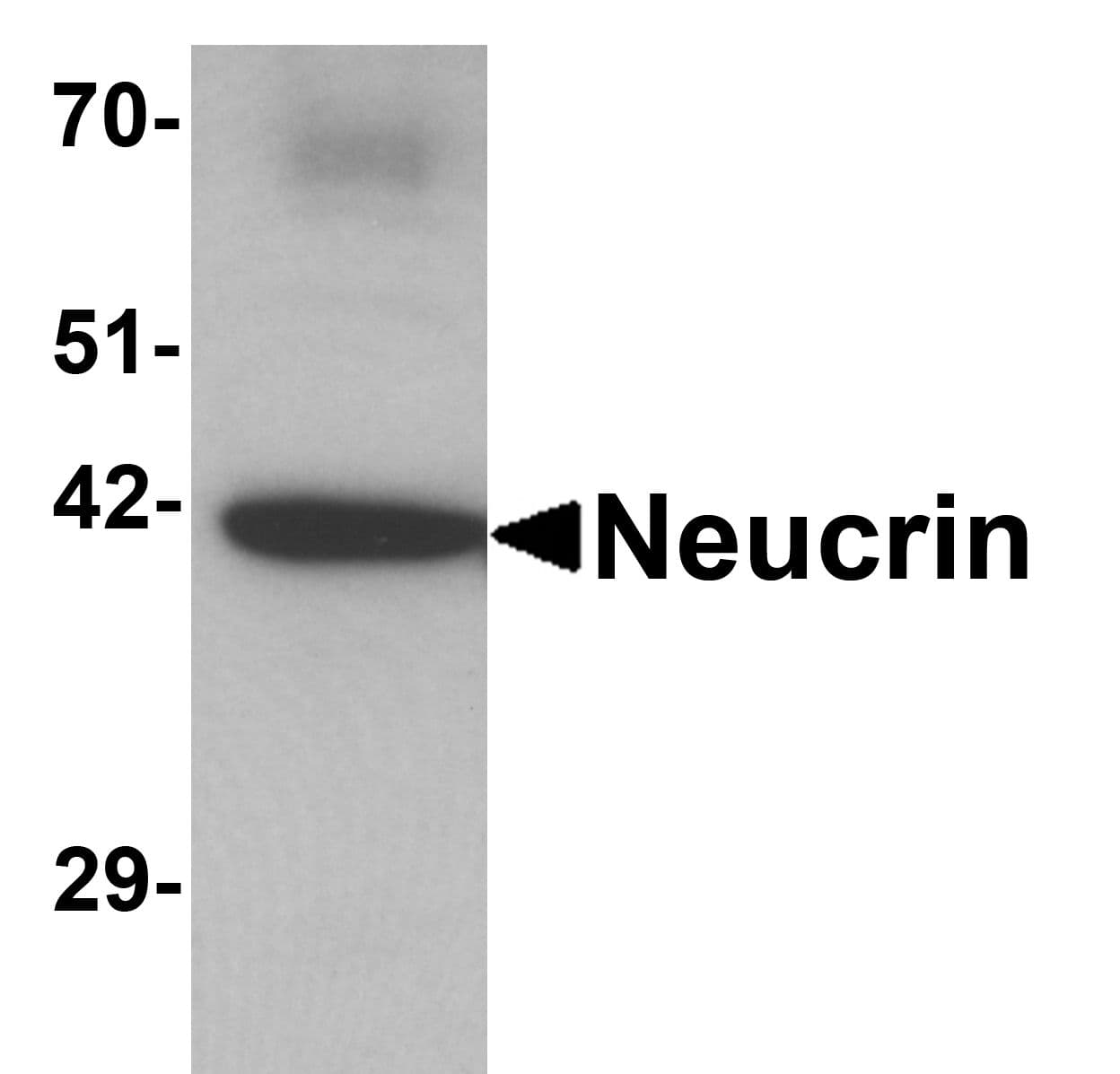 IHC-plus™ C1orf187 / DRAXIN Antibody