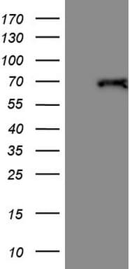 Monoclonal Mouse anti-Human THRA / THR Alpha Antibody (clone OTI6B7, aa1-220, WB)