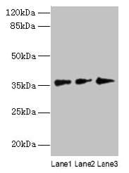 LDAH Antibody