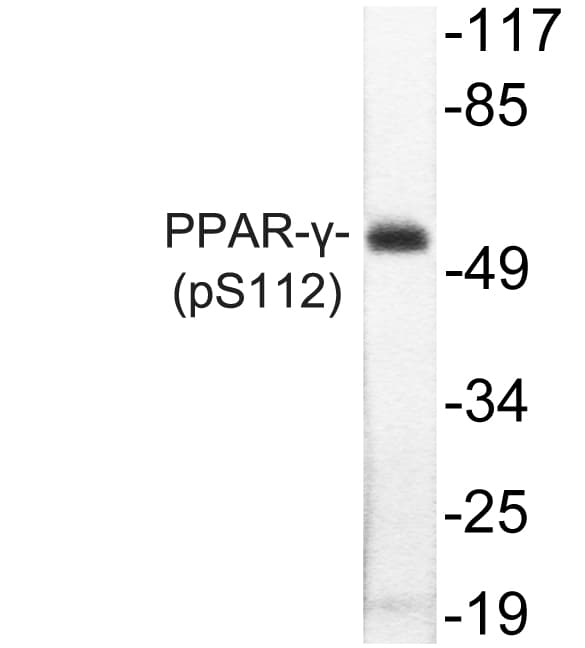 Polyclonal Rabbit anti-Human PPARG / PPAR Gamma Antibody (phospho-Ser112, WB)