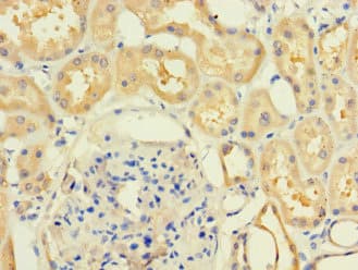 Polyclonal Rabbit anti-Human MR1 Antibody (IHC, IF, WB)