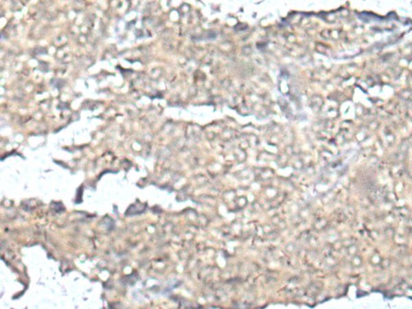 Polyclonal Rabbit anti-Human MEF2D Antibody (IHC)
