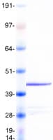 Human FMOD / Fibromodulin Protein (Recombinant Myc-DDK (Flag))
