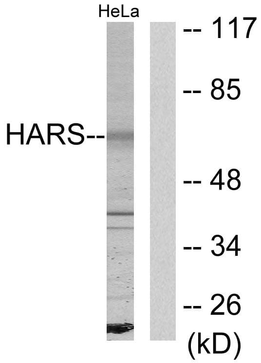 HARS Antibody