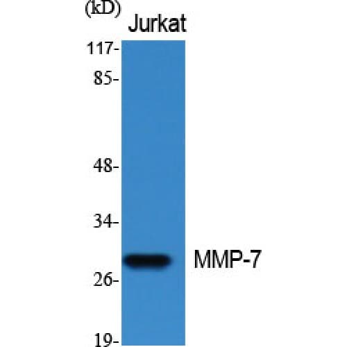 MMP7 / Matrilysin Antibody (190-270 aa, C-terminal)