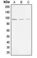 MAP3K11 / MLK3 Antibody (phospho-Thr277/Ser281)