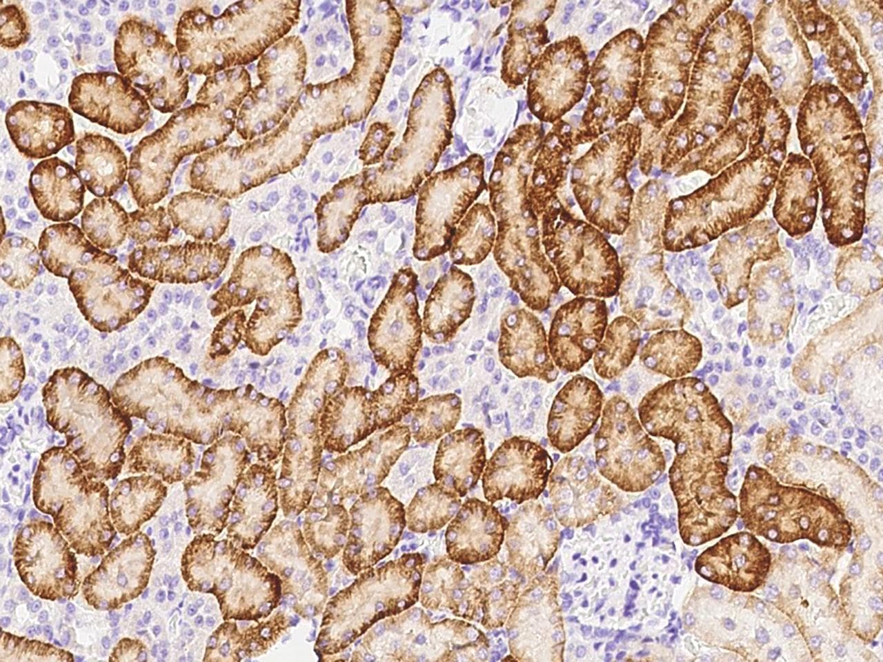 Polyclonal Rabbit anti-Mouse STX6 / Syntaxin 6 Antibody (Preservative Free, IHC)