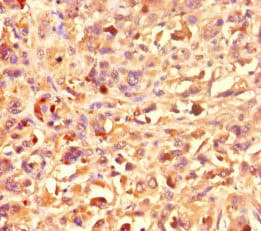 Polyclonal Rabbit anti-Human KAT2B / PCAF Antibody (IHC)