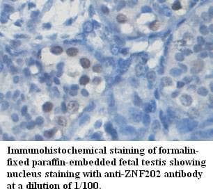 ZNF202 Antibody (aa232-488)