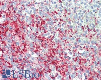 IHC-plus™ TUBB1 / Tubulin Beta 1 Antibody (clone 4A3)