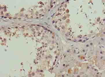 HIST2H2AC Antibody