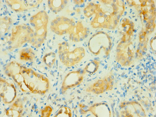 BCAT2 Antibody (aa20-200)