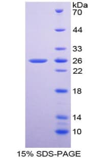 Human SOD2 / Mn SOD Protein (Recombinant His-T7)