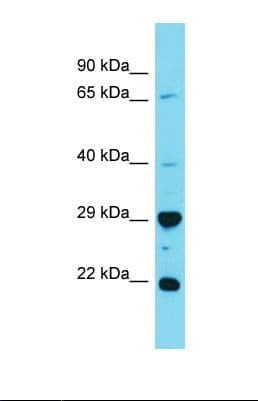 HAUS2 Antibody (aa58-107)