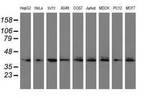 UBE2J1 Antibody (clone OTI3D1)