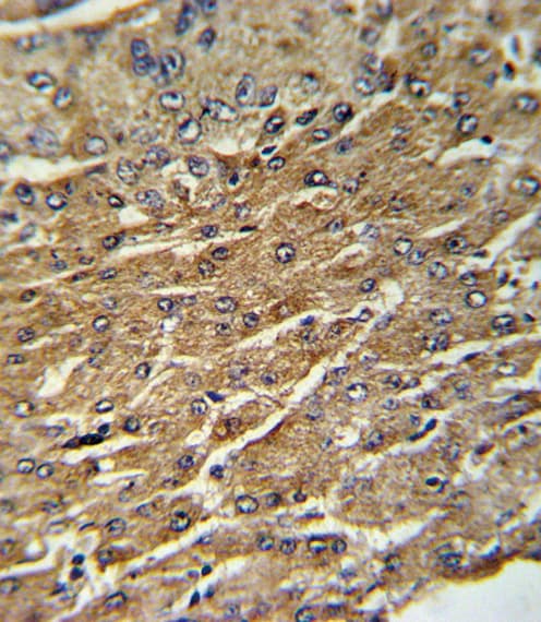 GPT / Alanine Transaminase Antibody (aa86-112)