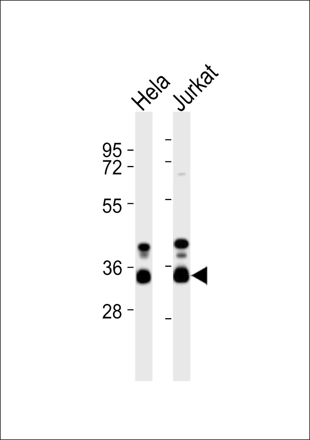 HNRPA1 / HnRNP A1 Antibody