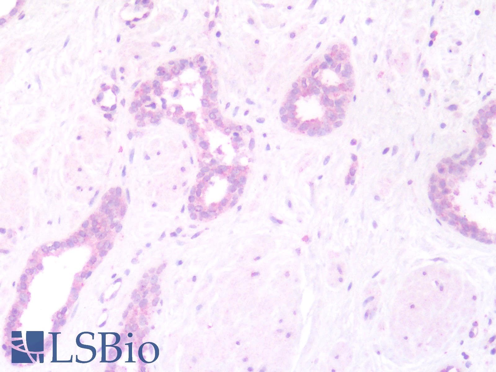 IHC-plus™ WNT5B Antibody (Internal)