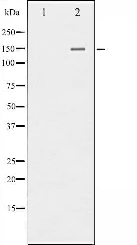 PLCG2 / PLC Gamma 2 Antibody (phospho-Tyr753)
