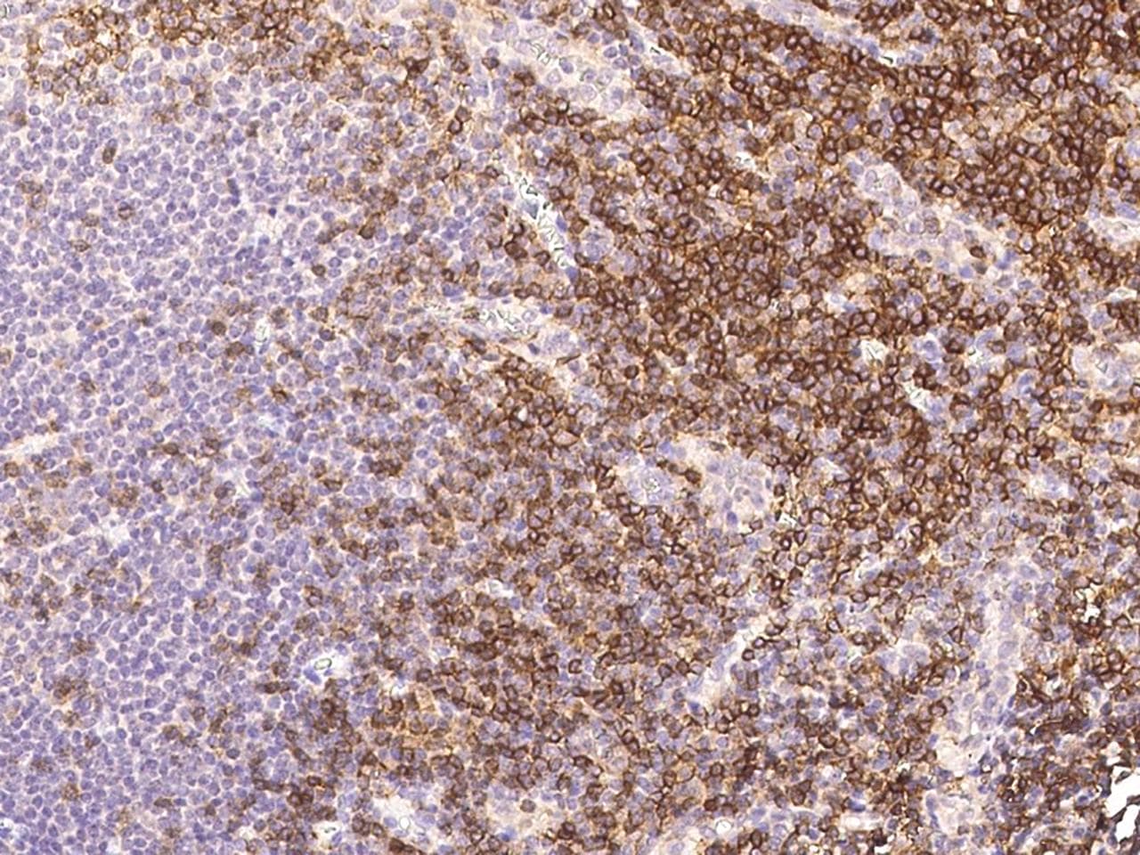 CD4 Antibody (clone 23, Preservative Free)