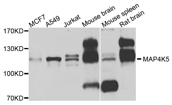 MAP4K5 Antibody (AP)